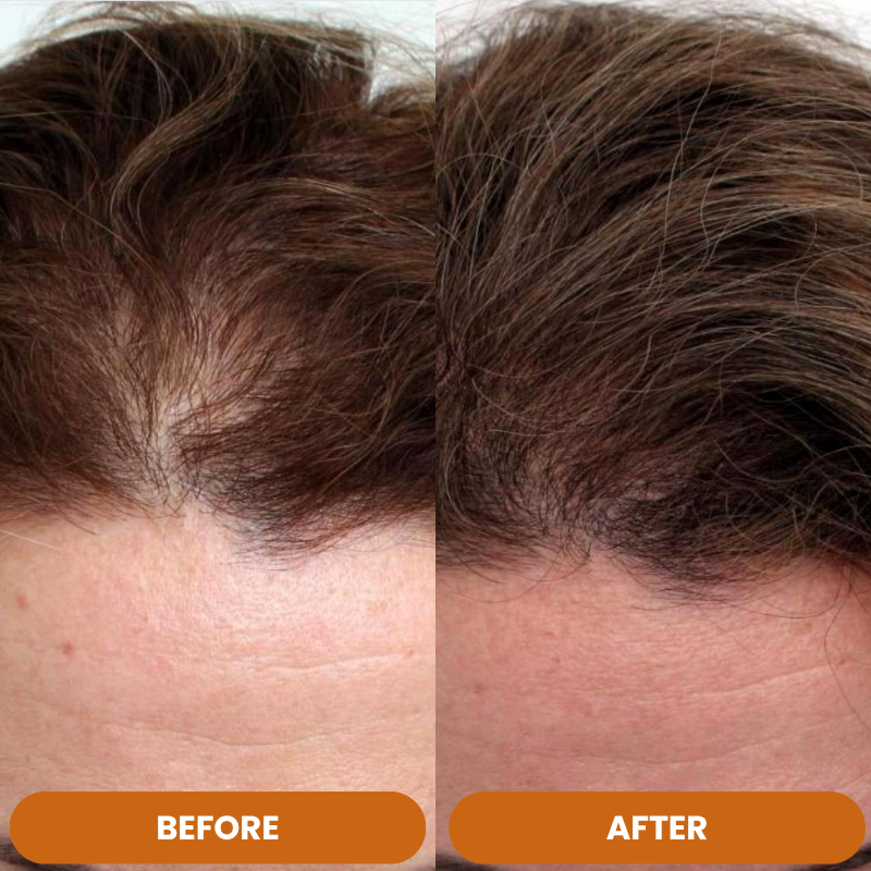 Finally Stop the Shedding That's Stealing Your Confidence