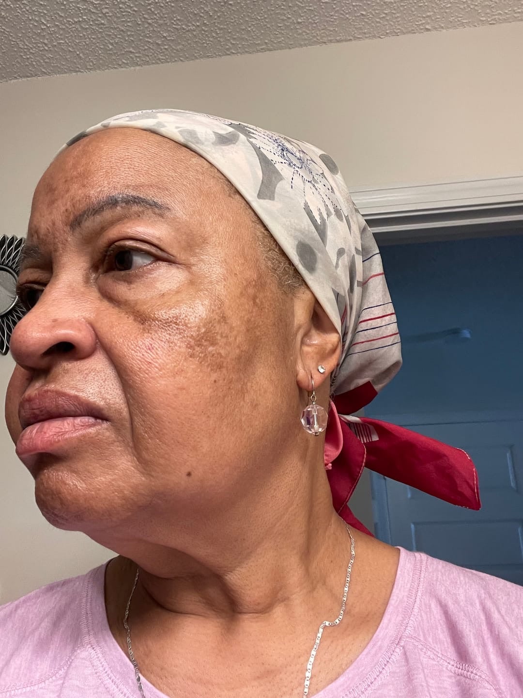 Finones Skin Vitamin Serum – Erase Hyperpigmentation & Reveal Your Radiant Glow