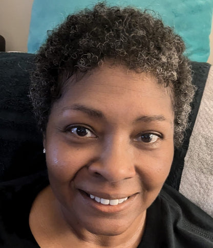 Finones Skin Vitamin Serum – Erase Hyperpigmentation & Reveal Your Radiant Glow