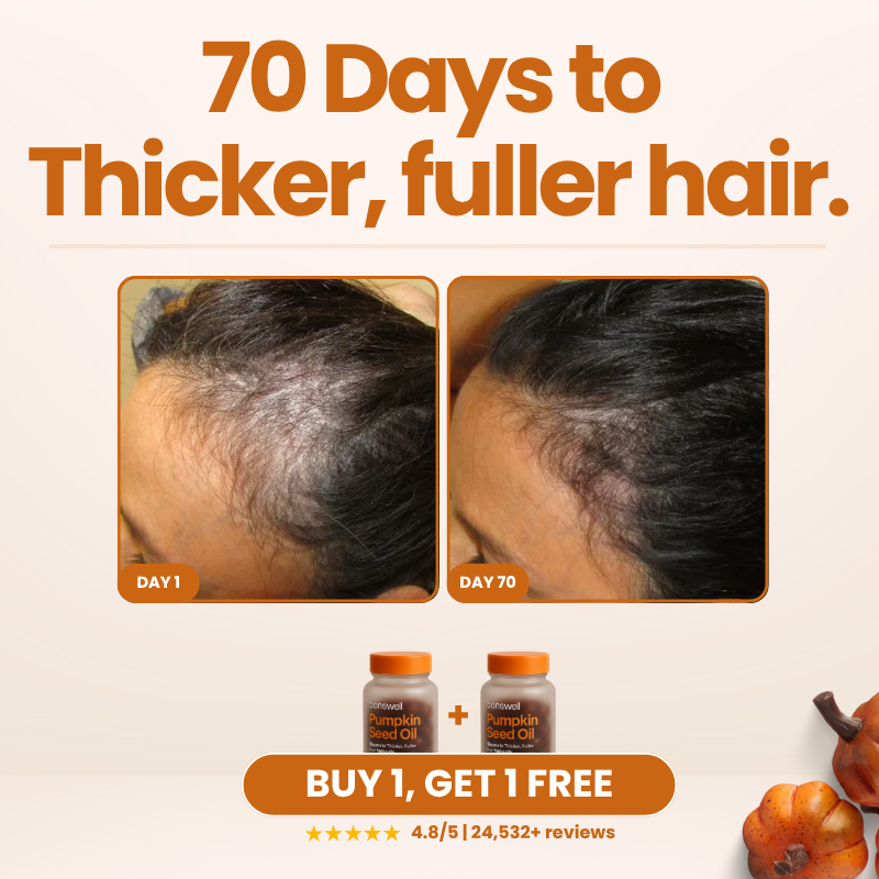 Finally Stop the Shedding That's Stealing Your Confidence