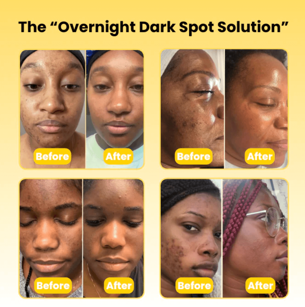 Kojic Acid Turmeric Overnight Mask – Fade Dark Spots & Wake Up Glowing